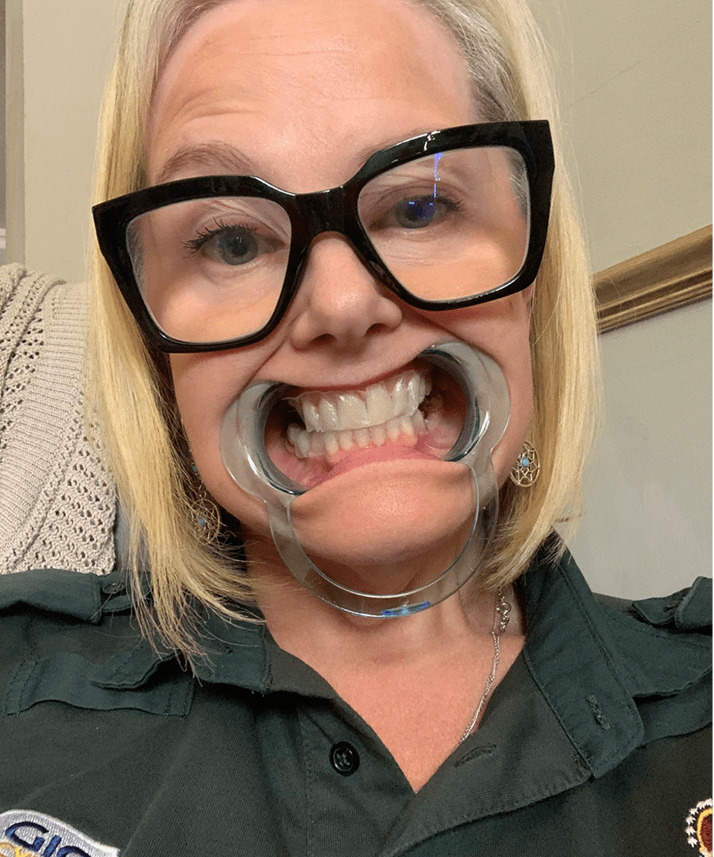 PROFESJONALNE WYBIELANIE ZĘBÓW W DOMU